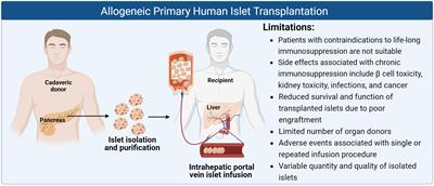 Innovations in bio-engineering and cell-based approaches to address immunological challenges in islet transplantation